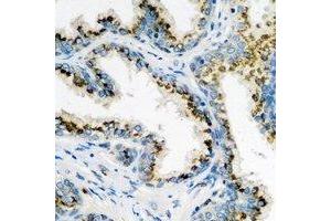 Immunohistochemical analysis of ARL6 staining in human prostate formalin fixed paraffin embedded tissue section. (ARL6 anticorps)