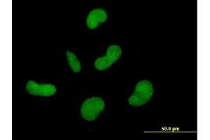 Immunofluorescence of purified MaxPab antibody to ZNF350 on HepG2 cell. (ZNF350 anticorps  (AA 1-532))