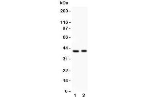 Western blot testing of IRF4 antibody and Lane 1:  HeLa;  2: Jurkat;  Predicted size: 51KD;  Observed size: 40KD