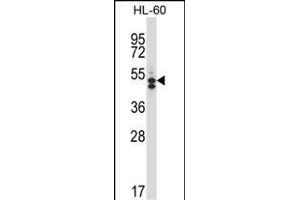 HDAC7 Antibody (C-term) (ABIN657570 and ABIN2846576) western blot analysis in HL-60 cell line lysates (35 μg/lane). (HDAC7 anticorps  (C-Term))