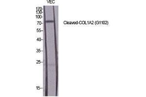 Western Blot (WB) analysis of specific cells using Cleaved-COL1A2 (G1102) Polyclonal Antibody.