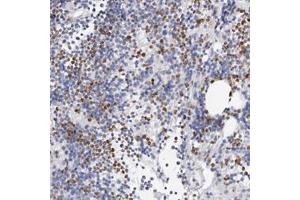 Immunohistochemical staining of human bone marrow with SLC10A5 polyclonal antibody  shows distinct nuclear and cytoplasmic positivity in subsets of bone marrow poietic cells. (SLC10A5 anticorps)