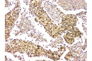 IHC analysis of EIF6 using anti-EIF6 antibody (ABIN6719594).
