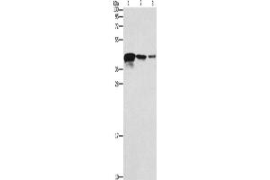 Western Blotting (WB) image for anti-Twinfilin, Actin-Binding Protein, Homolog 2 (Drosophila) (TWF2) antibody (ABIN5548106) (TWF2 anticorps)