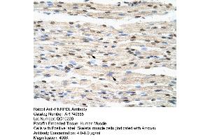 Rabbit Anti-HNRPDL Antibody  Paraffin Embedded Tissue: Human Muscle Cellular Data: Skeletal muscle cells Antibody Concentration: 4. (HNRPDL anticorps  (Middle Region))