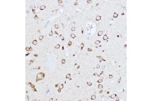 Immunohistochemistry of paraffin-embedded rat brain using YTHDF3 Rabbit pAb (ABIN6130934, ABIN6150345, ABIN6150346 and ABIN6224441) at dilution of 1:500 (40x lens).