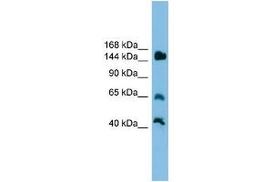 WB Suggested Anti-Jarid2 Antibody Titration: 0. (JARID2 anticorps  (Middle Region))