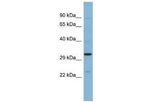 SET antibody used at 1 ug/ml to detect target protein. (SET/TAF-I anticorps  (N-Term))