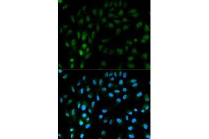 Immunofluorescence analysis of MCF7 cell using TFPI antibody.