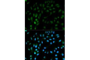 Immunofluorescence analysis of MCF7 cell using TFPI antibody. (TFPI anticorps  (AA 29-224))