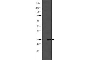 Western blot analysis of PROP1 expression in A431 whole cell lysate ,The lane on the left is treated with the antigen-specific peptide. (PROP1 anticorps  (Internal Region))