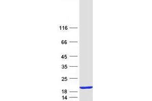Validation with Western Blot