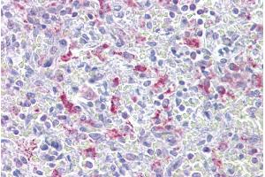 Immunohistochemistry with Spleen tissue at an antibody concentration of 5µg/ml using anti-EZH1 antibody (ARP38092_P050)