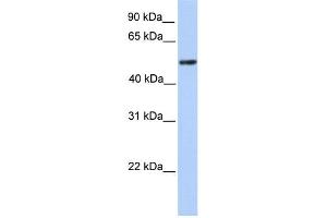 WB Suggested Anti-ZBTB9 Antibody Titration:  0. (ZBTB9 anticorps  (C-Term))