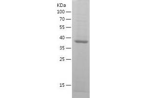 Western Blotting (WB) image for Thymidine Phosphorylase (TYMP) (AA 224-383) protein (His-IF2DI Tag) (ABIN7125384)