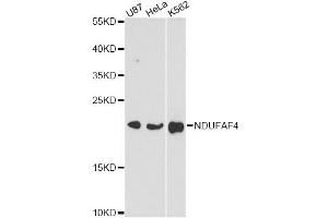 Western blot analysis of extracts of various cell lines, using NDUFAF4 antibody (ABIN6293778) at 1:3000 dilution. (NDUFAF4 anticorps)