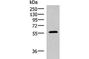 Western blot analysis of Mouse small intestines tissue lysate using PEPD Polyclonal Antibody at dilution of 1:1000 (PEPD anticorps)
