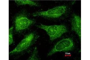 Immunofluorescence analysis of methanol-fixed HeLa, using c-Yes antibody at 1:200 dilution.