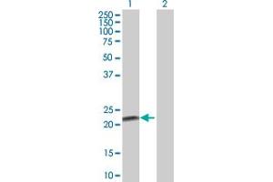 Western Blot analysis of FKBP11 expression in transfected 293T cell line by FKBP11 MaxPab polyclonal antibody.