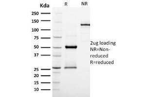 anti-Podocalyxin-Like (PODXL) (AA 310-447) antibody