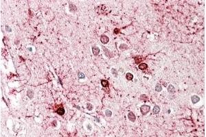 ABIN571123 (3. (GLUD1 / GLUD2 (Internal Region) anticorps)