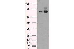 Western Blotting (WB) image for anti-Aconitase 2, Mitochondrial (ACO2) antibody (ABIN1496410) (ACO2 anticorps)
