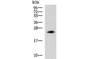 Western blot analysis of NIH/3T3 cell lysate using CLTB Polyclonal Antibody at dilution of 1:800 (CLTB anticorps)