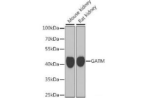 Western blot analysis of extracts of various cell lines using GATM Polyclonal Antibody at dilution of 1:1000. (GATM anticorps)