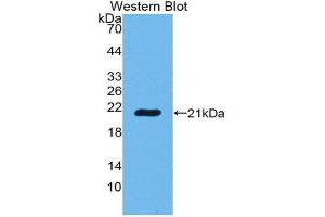 Western Blotting (WB) image for anti-POTE Ankyrin Domain Family, Member G (POTEG) (AA 177-330) antibody (ABIN1980492) (POTEG anticorps  (AA 177-330))