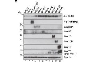 Wnt ligand production increases Evi protein levelsIn situ RNA hybridization (red dots) and immunohistochemistry (brown staining) of Evi were performed on sequential FFPE tissue slides of healthy colon and matched colon cancer tissue from five patients.