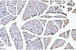 IHC analysis of NCL using anti-NCL antibody (ABIN7600662). (Nucleolin anticorps  (AA 219-629))
