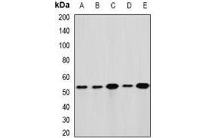 Western blot analysis of GLUD1 expression in Hela (A), HepG2 (B), mouse liver (C), mouse brain (D), rat kidney (E) whole cell lysates.