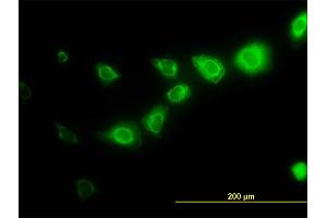 Immunofluorescence of monoclonal antibody to CAPNS1 on HeLa cell. (Calpain S1 anticorps  (AA 172-260))