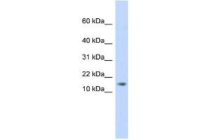 WB Suggested Anti-C11orf67 Antibody Titration: 0. (AAMDC anticorps  (Middle Region))