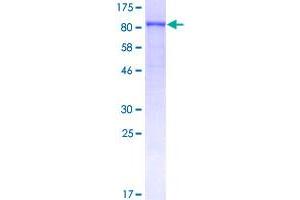 Image no. 1 for Fibroblast Growth Factor Receptor 2 (FGFR2) (AA 1-723) protein (GST tag) (ABIN1354039)