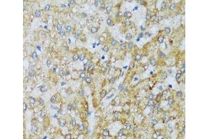 Immunohistochemistry of paraffin-embedded Human liver using C1QC Polyclonal Antibody at dilution of 1:100 (40x lens). (C1QC anticorps)