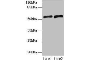 Western blot All lanes: SLC2A4 antibody at 2 μg/mL Lane 1: Mouse heart tissue Lane 2: Hela whole cell lysate Secondary Goat polyclonal to rabbit IgG at 1/10000 dilution Predicted band size: 55, 44 kDa Observed band size: 55 kDa (GLUT4 anticorps  (AA 223-287))