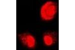 Immunofluorescent analysis of PSMB1 staining in U2OS cells. (PSMB1 anticorps)