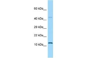 WB Suggested Anti-Hmga1 Antibody Titration: 2 ug/ml Positive Control: Rat Small Intestine (HMGA1 anticorps  (N-Term))