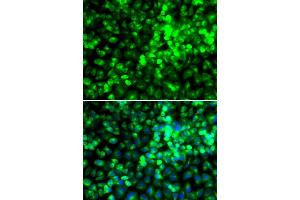 Immunofluorescence analysis of A549 cells using EIF2AK4 antibody. (GCN2 anticorps)