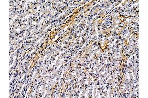 anti-C3 and PZP-Like, alpha-2-Macroglobulin Domain Containing 8 (CPAMD8) antibody