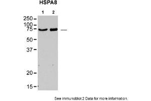 Sample type: rat brain lysatePrimary Dilution: 1:1000Image Submitted By: Jennifer Morgan, PhD &, David BuschUniversity of Texas in Austin