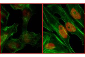 Immunofluorescence (IF) image for anti-Replication Protein A2, 32kDa (RPA2) (pSer4), (pSer8) antibody (ABIN7455212) (RPA2 anticorps  (pSer4, pSer8))