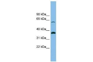 SLC25A4 antibody used at 1 ug/ml to detect target protein. (SLC25A4 anticorps)