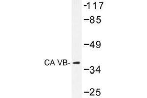 Image no. 1 for anti-Carbonic Anhydrase VB, Mitochondrial (CA5B) antibody (ABIN317824) (CA5B anticorps)