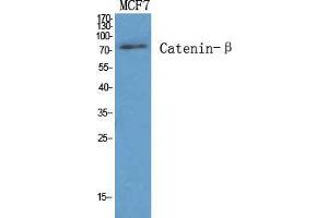 Western Blot (WB) analysis of specific cells using Catenin-beta Polyclonal Antibody.