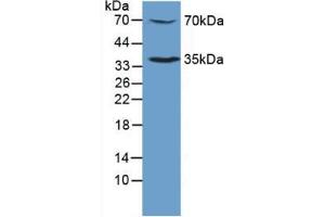 Figure. (MPL anticorps  (AA 311-460))