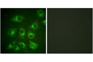 Immunofluorescence analysis of HuvEc cells, using CrkII (Ab-221) Antibody.