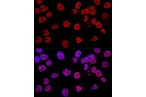 Confocal immunofluorescence analysis of Hela cells using WT1 Polyclonal Antibody (ABIN7271369) at dilution of 1:200. (WT1 anticorps  (AA 1-302))