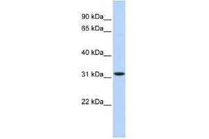 HIBADH antibody used at 1 ug/ml to detect target protein. (HIBADH anticorps  (Middle Region))